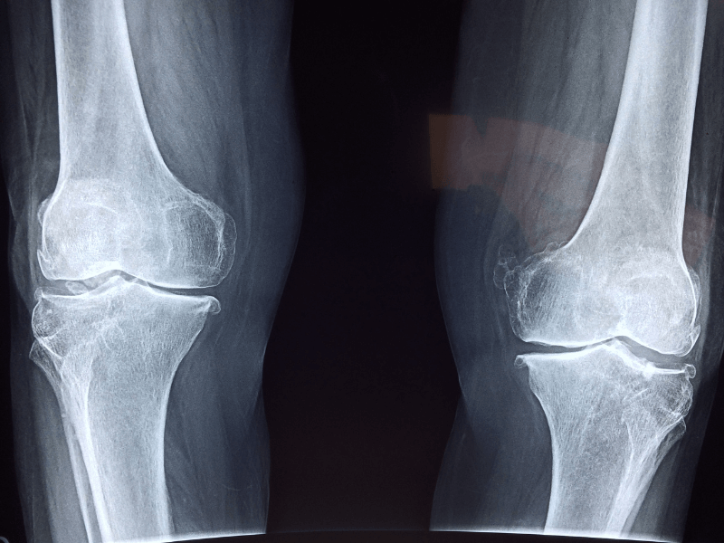 Pregled ortopeda - RTG snimka