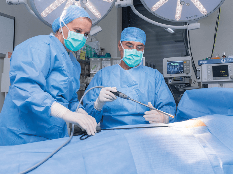 Operacije abdomena laporaskopski